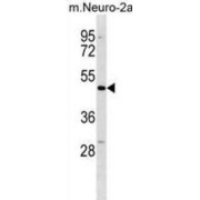 Doublecortin Domain-Containing Protein 2 (DCDC2) Antibody