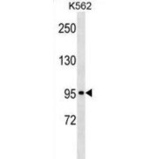 Mast/Stem Cell Growth Factor Receptor Kit (KIT) Antibody