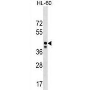 Mitochondrial Ribosomal Protein S31 (MRPS31) Antibody