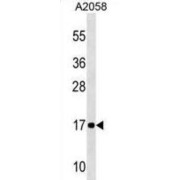 NADH Ubiquinone Oxidoreductase Subunit A12 (NDUFA12) Antibody