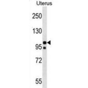 WB analysis of uterus tissue lysates.