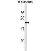 Ring Finger Protein 122 (RNF122) Antibody