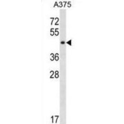 SGT1 Homolog, MIS12 Kinetochore Complex Assembly Cochaperone (SUGT1) Antibody