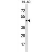 Armadillo Repeat-Containing X-Linked Protein 4 (ARMCX4) Antibody