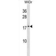 ATP Synthase Subunit G 2, Mitochondrial (ATP5L2) Antibody