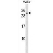 Class A Basic Helix-Loop-Helix Protein 9 (BHLHA9) Antibody