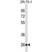 Killer Cell Lectin-Like Receptor Subfamily F Member 2 (KLRF2) Antibody