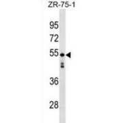Keratin-81-Like Protein (KT81L) Antibody