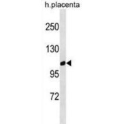 G-Protein Coupled Receptor Family C Group 6 Member A (GPRC6A) Antibody