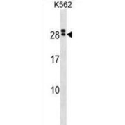 Interleukin 15 Receptor Subunit Alpha (IL15RA) Antibody