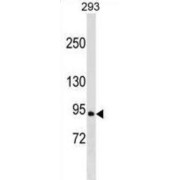 Ral Guanine Nucleotide Dissociation Stimulator (RALGDS) Antibody