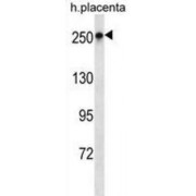 Protein Scribble Homolog (SCRIB) Antibody