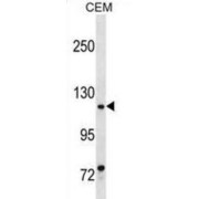 Megakaryocytic Acute Leukemia Protein (MKL1) Antibody