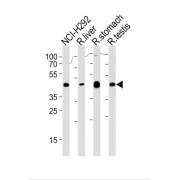 Polycomb Group RING Finger Protein 6 (PCGF6) Antibody