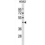 Pellino E3 Ubiquitin Protein Ligase 1 (PELI1) Antibody