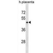 Perilipin 3 (PLIN3) Antibody