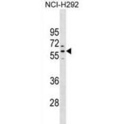 PRAME Family Member 1 (PRAMEF1) Antibody