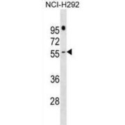 PRAME Family Member 16 (PRAMEF16) Antibody