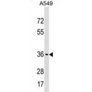 Ecto-ADP-Ribosyltransferase 6 (ART5) Antibody