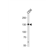 Receptor Tyrosine-Protein Kinase ErbB-2 (ERBB2) Antibody