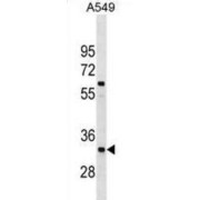 X-Ray Repair Cross-Complementing Protein 4 (XRCC4) Antibody