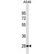 Vesicle-Associated Membrane Protein-Associated Protein B/C (VAPB) Antibody