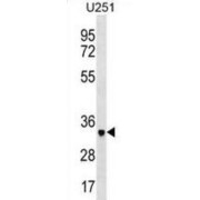 N-Acetylneuraminate Lyase (NPL) Antibody