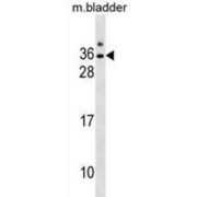 Putative Gap Junction Epsilon-1 Protein (GJE1) Antibody