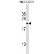 DPY30 Domain-Containing Protein 2 (DYDC2) Antibody