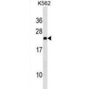 Nucleolar Protein 16 (NOP16) Antibody