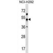 Inward Rectifier Potassium Channel 18 (KCNJ18) Antibody