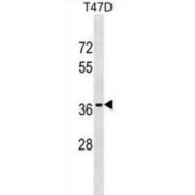 Olfactory Receptor Family 10 Subfamily T Member 2 (OR10T2) Antibody