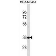 DnaJ (Hsp40) Homolog, Subfamily B, Member 2 (DNAJB2) Antibody