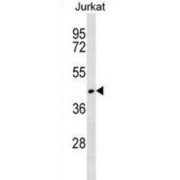 RUN Domain Containing 3A (RUNDC3A) Antibody