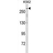 Sodium Voltage-Gated Channel Alpha Subunit 5 (SCN5A) Antibody