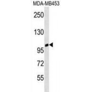 Ankyrin Repeat Domain-Containing Protein 20A3 (ANKRD20A3) Antibody