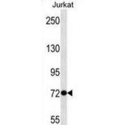 Ankyrin Repeat Domain-Containing Protein 56 (ANKRD56) Antibody