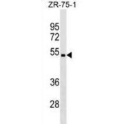 Carbohydrate Sulfotransferase 5 (CHST5) Antibody