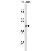 Melanocortin Receptor 5 (MC5R) Antibody