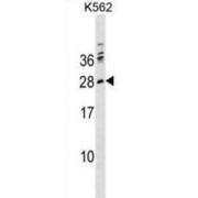 WB analysis of K562 cell line lysates.