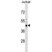 Cysteine Rich With EGF Like Domains 2 (CRELD2) Antibody