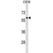 Tripartite Motif-Containing Protein 58 (TRIM58) Antibody