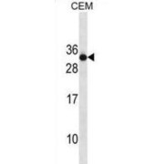 Ras-Related Protein Rab-4B (RAB4B) Antibody