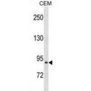 Prolyl Endopeptidase (PREP) Antibody