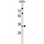 Actin Related Protein 2/3 Complex Subunit 2 (ARPC2) Antibody