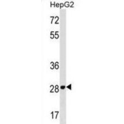 Phosphomannomutase 2 (PMM2) Antibody