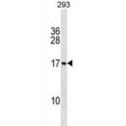 Protein PAPPAS (PAPPAS) Antibody