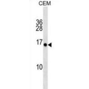 Plasminogen-Like Protein A (PLGLA) Antibody