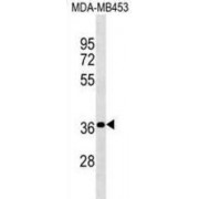 Pregnancy Specific Beta-1-Glycoprotein 4 (PSG4) Antibody