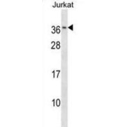 RAB8B, Member RAS Oncogene Family (RAB8B) Antibody